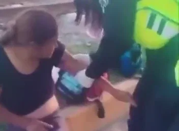 Carolina atacada por jauría de perros en Cuautlancingo